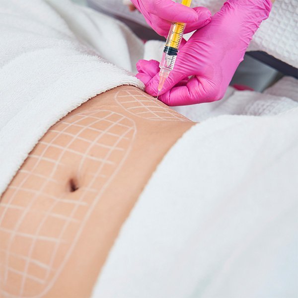 body-contouring-01